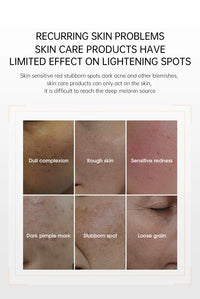 LED Light Therapy Face Mask with Neck Attachment